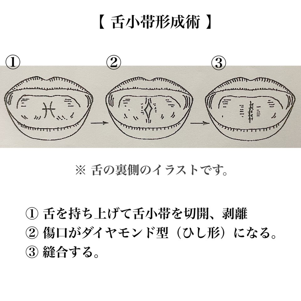 歯医者でいただいた資料のイラストを使用しています。